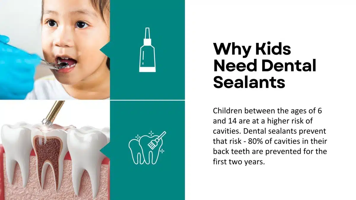 Why Do Kids Need Dental Sealants Gurnee IL