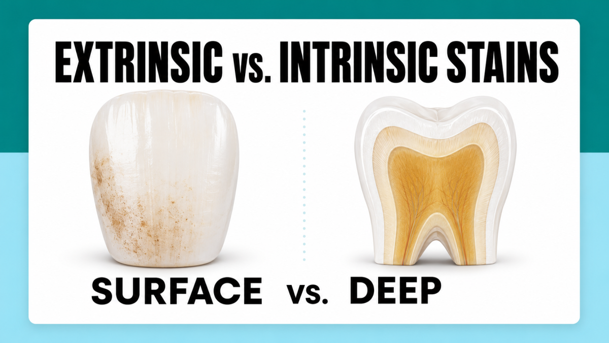 Extrinsic Vs Intrinsic Stains